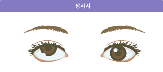 상사시
