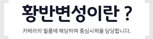 황반변성이란?
